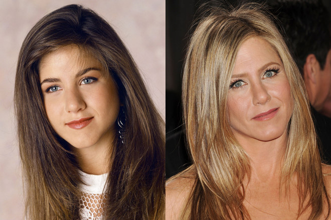 El antes y el después de Jennifer Aniston, caso de éxito de rinoplastia